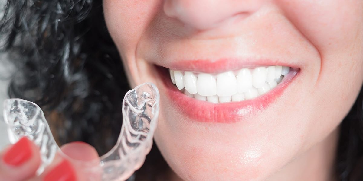 Maintaining Your Lifestyle with Invisalign: Advice from London’s Experts