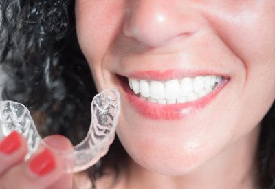 Maintaining Your Lifestyle with Invisalign: Advice from London’s Experts