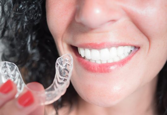 Maintaining Your Lifestyle with Invisalign: Advice from London’s Experts